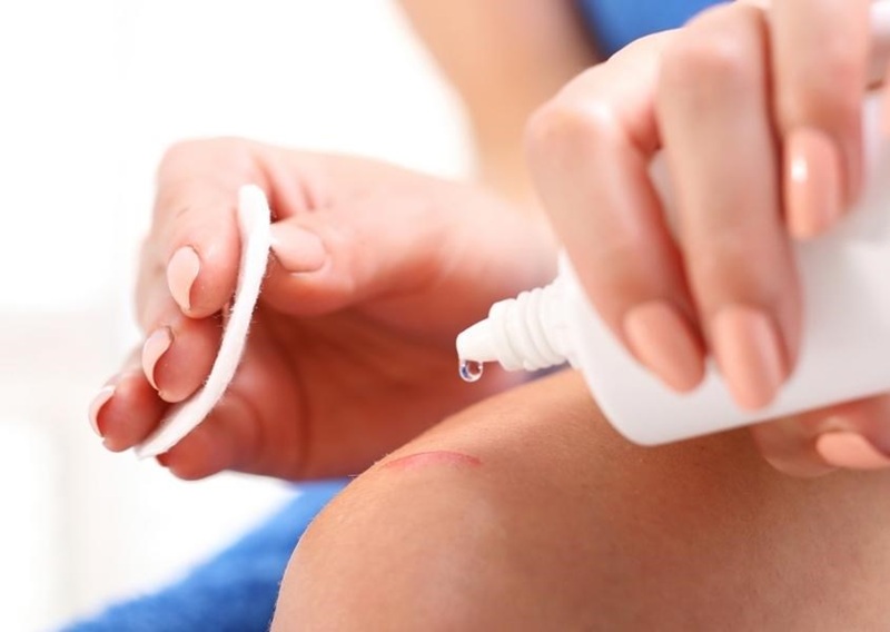 Rửa vết thương ngay lập tức bằng xà phòng dưới vòi nước chảy là bước sơ cứu quan trọng nhất để loại bỏ virus.