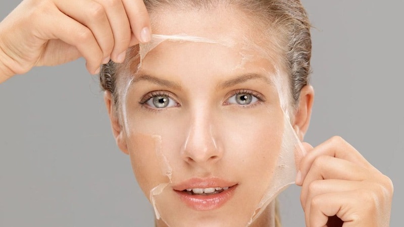 Tuyệt đối không tự ý dùng tay bóc các mảng da để tránh gây tổn thương và để lại sẹo.